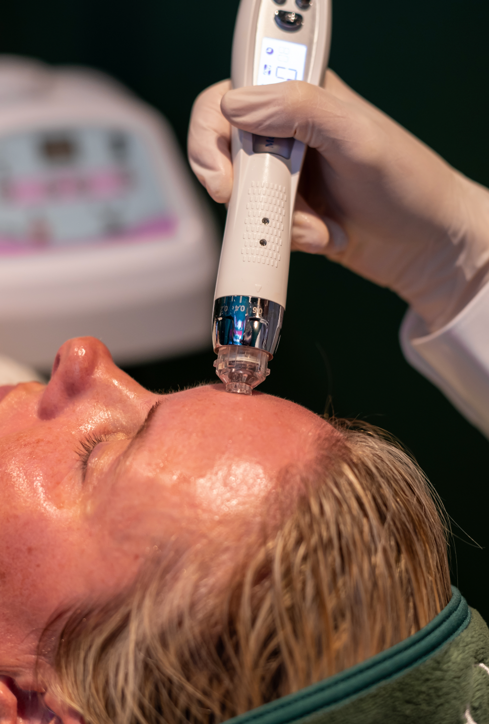 New Client | Skin Needling + Skin Consultation + LED | Mosman