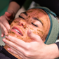 Herbal B Peel x 3 Series