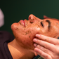 Herbal B Peel