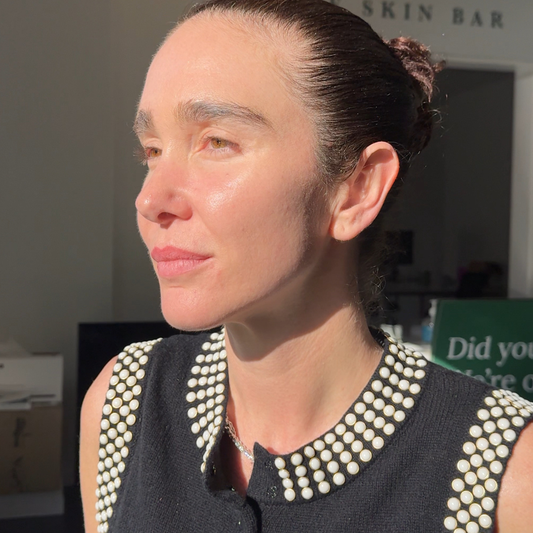 Skin Needling with Exosomes