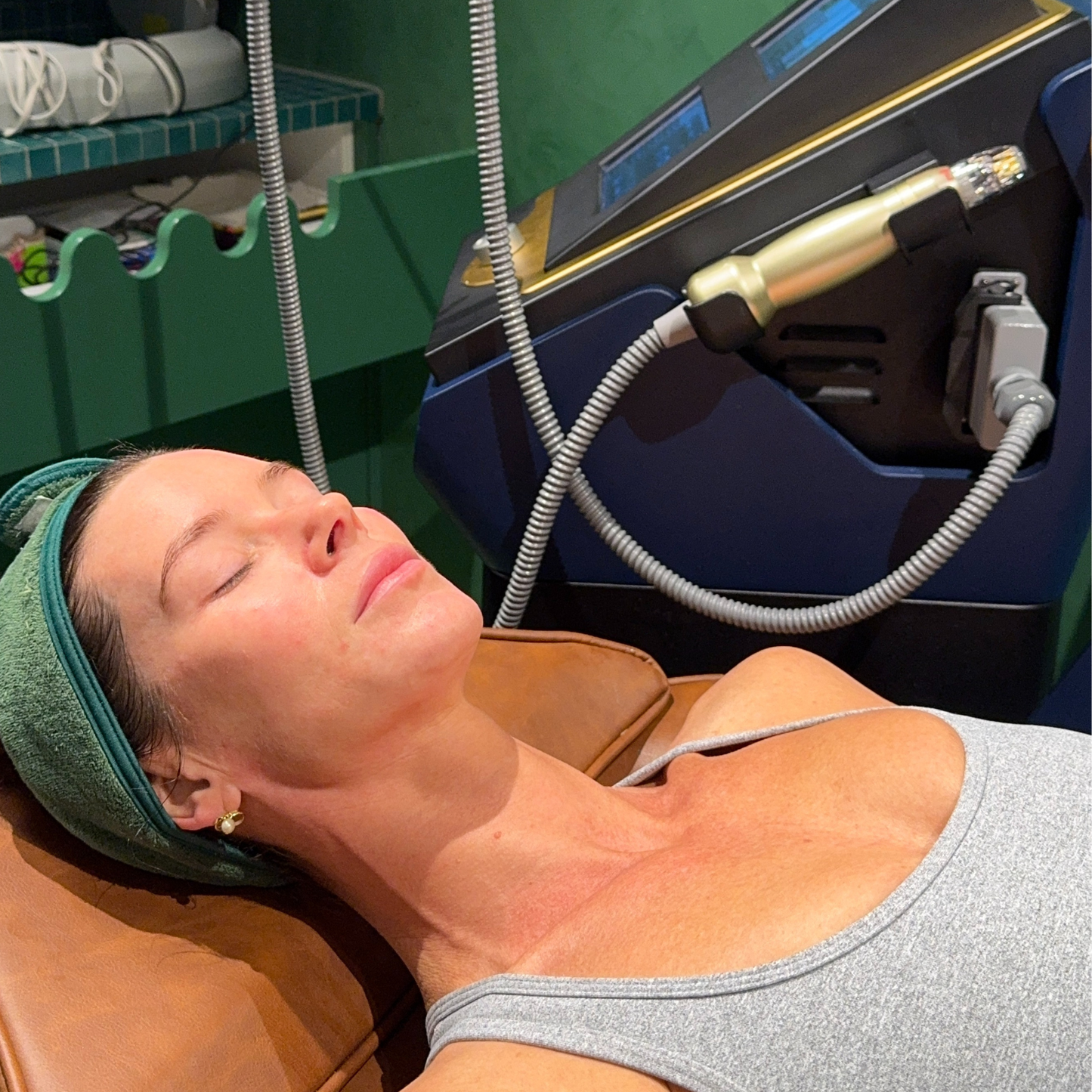 RF Needling x 3 Series