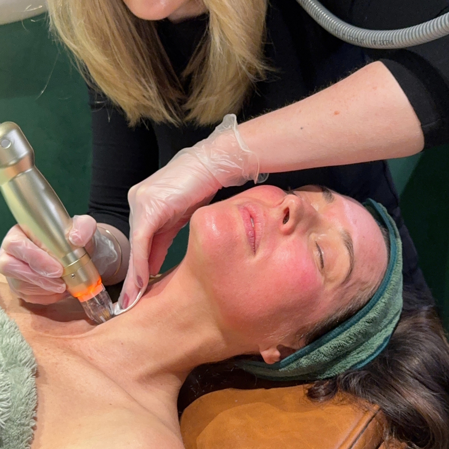 RF Needling x 3 Series