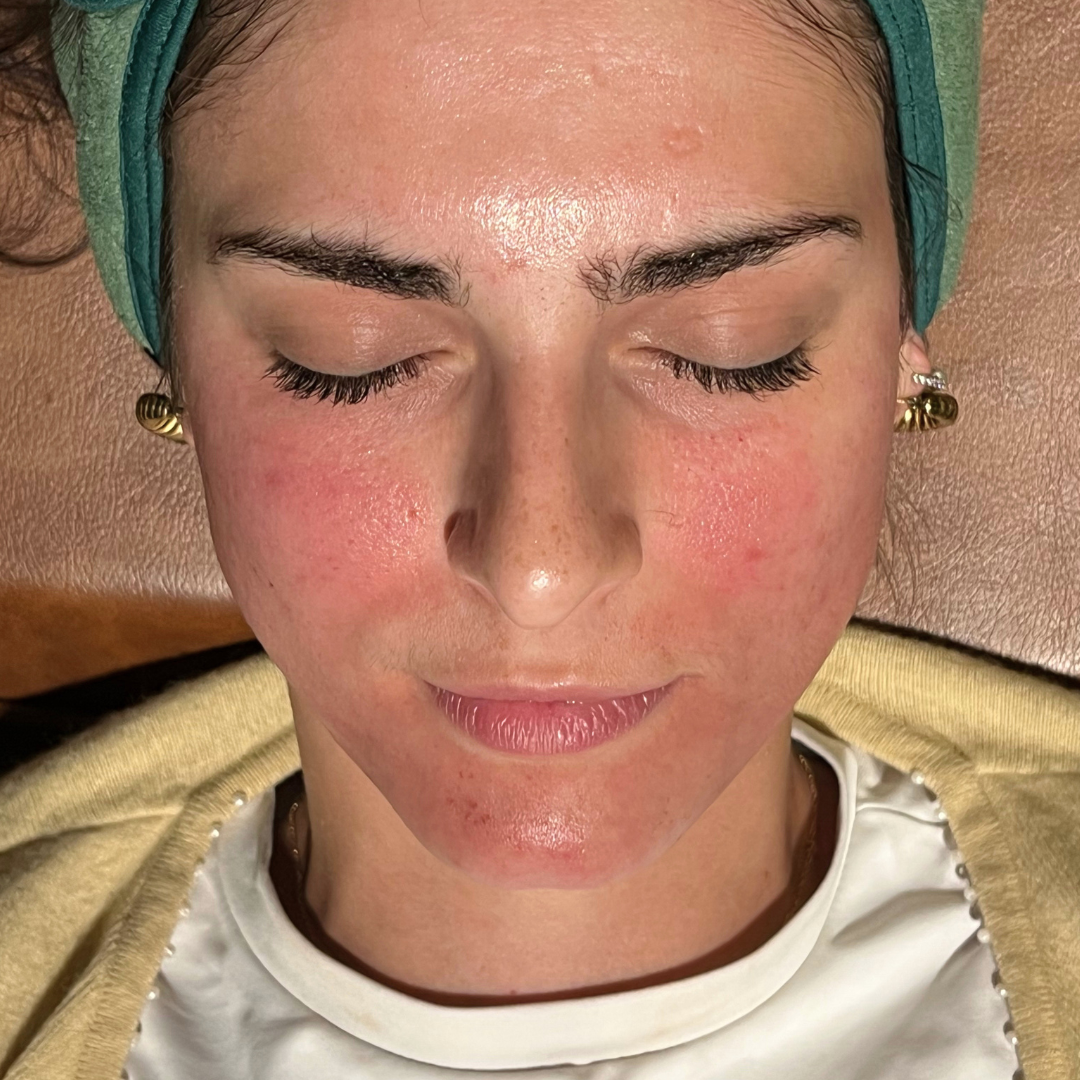 The Smooth, Sculpt & Snatch - Treatment Series