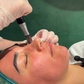 First-Time Skin Needling with Consultation & LED
