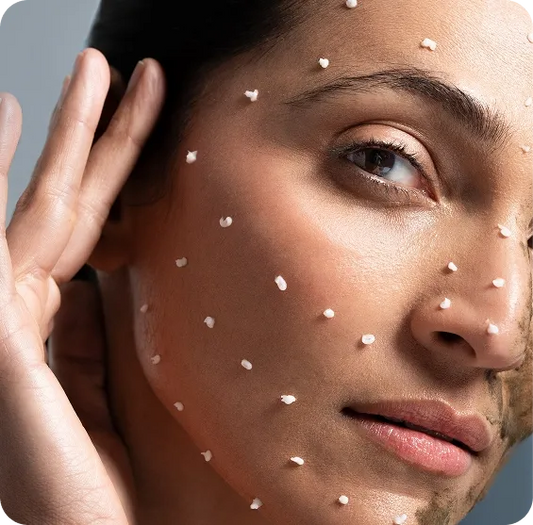 K-Beauty Spicule Treatment